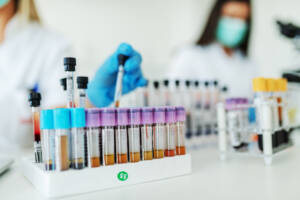 Laboratory blood test